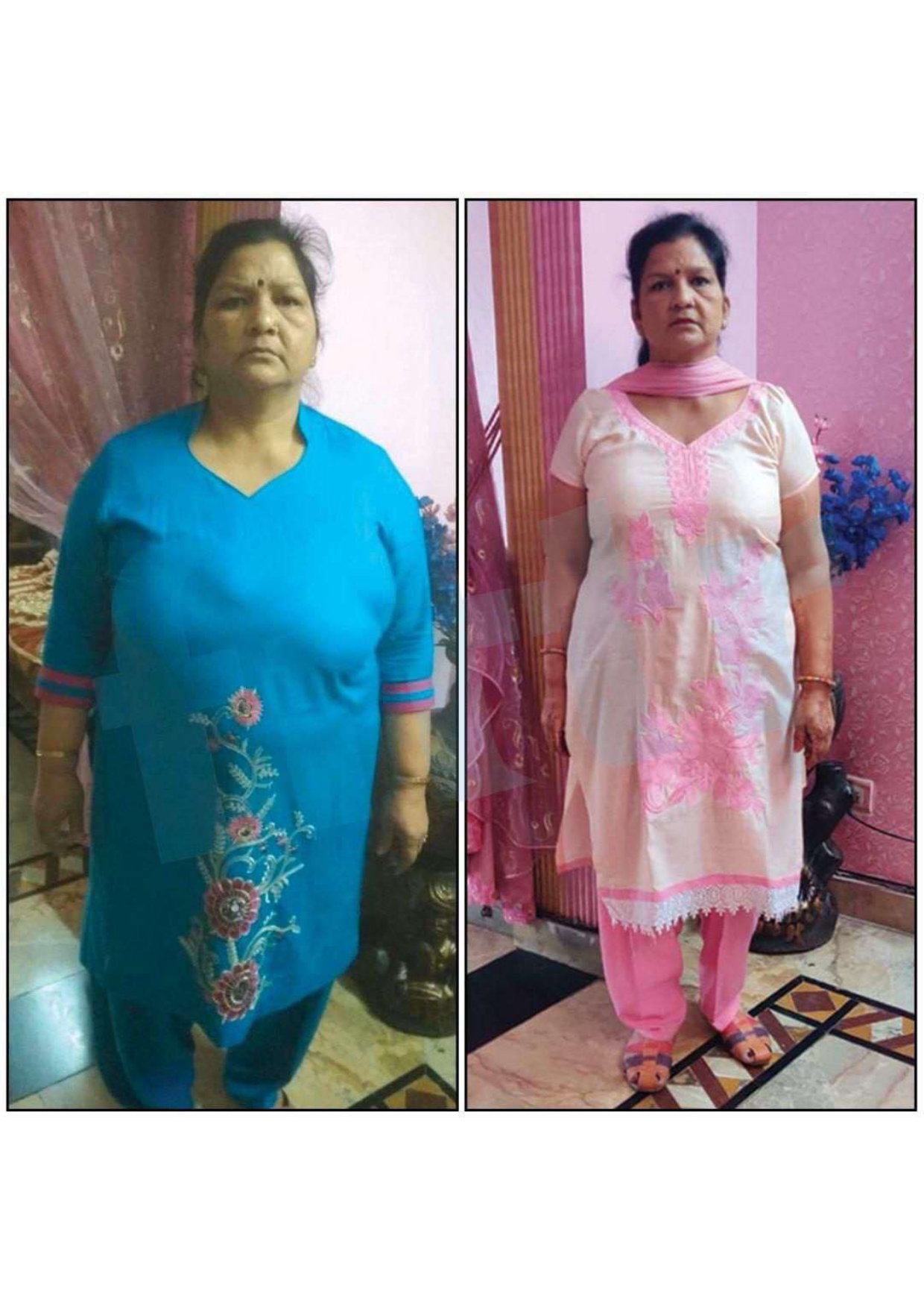 Sushma Yadav - 11 kg ayurvedic weight loss transformation from Hyderabad