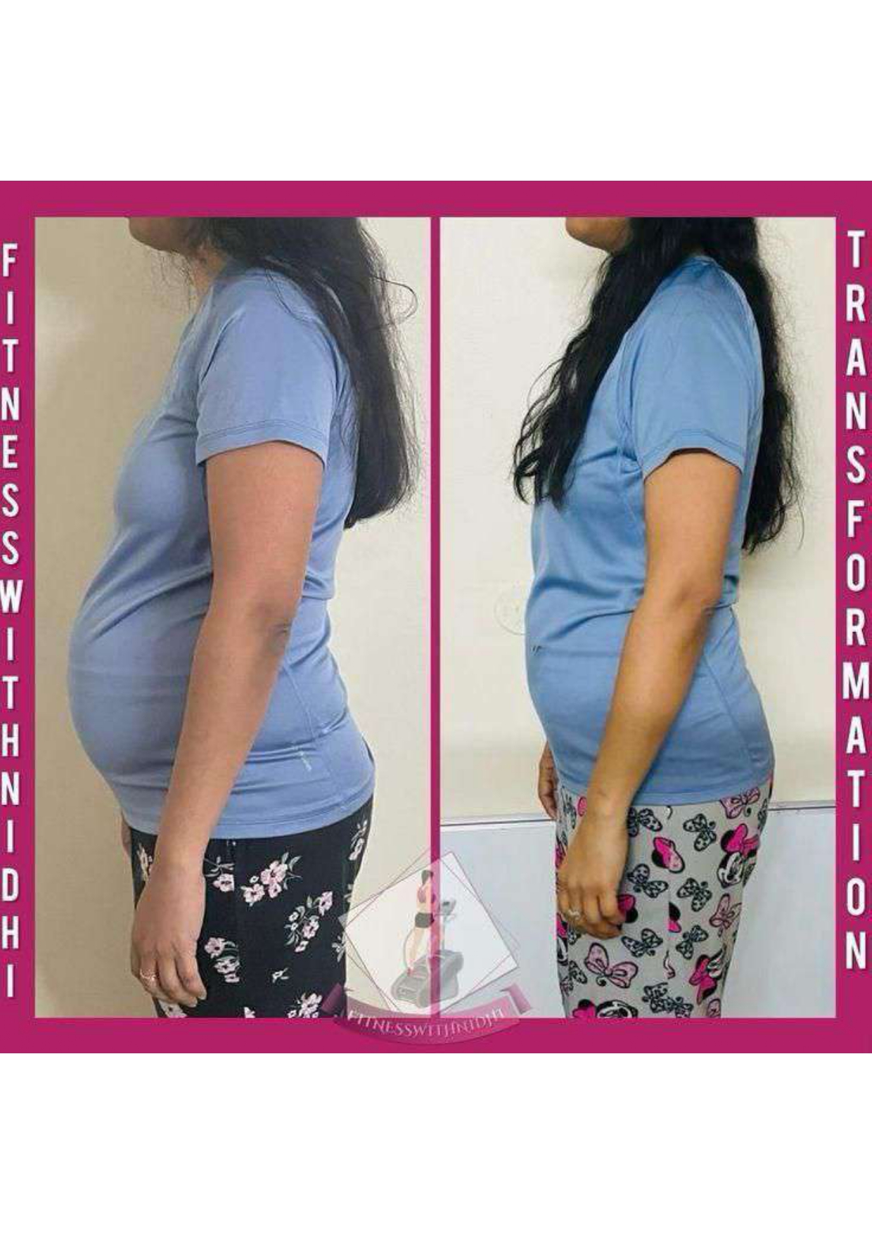 Nidhi Sharma - 9 kg ayurvedic weight loss transformation from Gurgaon