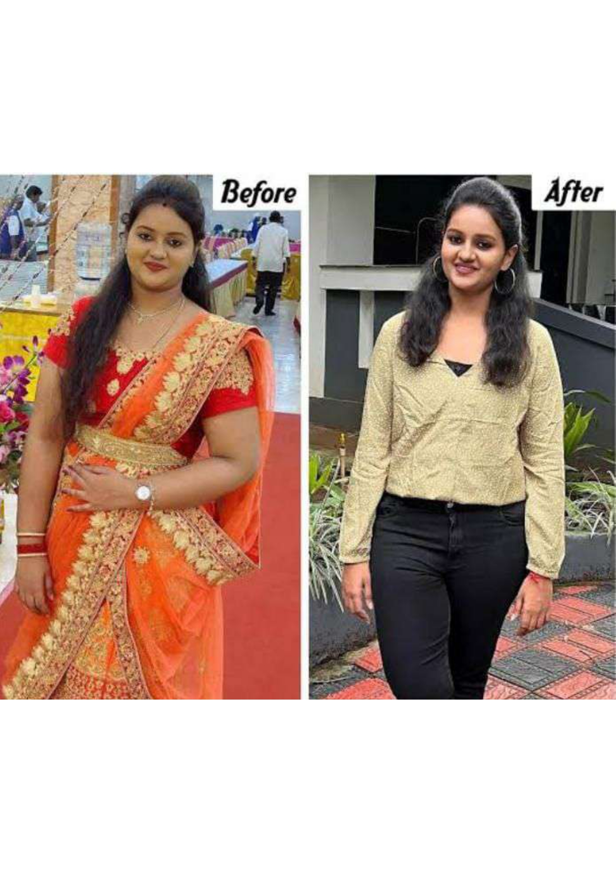 Anjali Patel - 20 kg ayurvedic weight loss transformation from Ahmedabad
